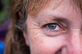 Estos remedios para bajar de peso podrían hacer envejecer tu cara más rápido de lo normal