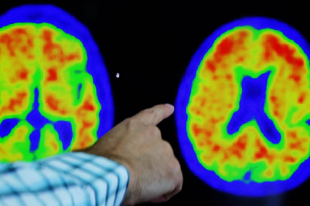 Esto es lo que pasa con tu cuerpo si consumes demasiada azúcar. Foto: REUTERS.