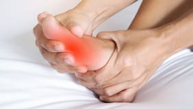 Qué es la gota y por qué están aumentando los casos alrededor del mundo