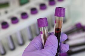 ¿Cómo funciona la primera prueba aprobada por la FDA para saber si tengo alzhéimer?