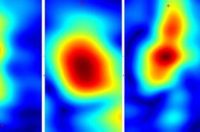 Crean un dispositivo capaz de detectar tejido canceroso con un 98% de eficacia