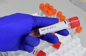 Un “unicornio inmunológico”: el sorprendente descubrimiento de un laboratorio que analizaba el coronavirus