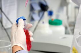 Científicos y la pausa en los ensayos de la U. de Oxford: ¿Y si nos quedamos sin vacuna?