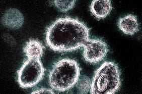 Nueve inéditas mutaciones no detectadas en ninguna parte del mundo potencian variante del Sars-CoV-2 que circula en Magallanes y que explicarían alto número de casos