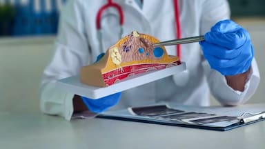 Científicos identifican cómo una red nerviosa potencia el cáncer de mama: esto dice su investigación