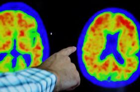 Científicos chilenos descubren una dieta capaz de frenar el envejecimiento del cerebro