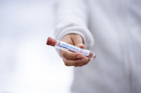 ¿Por qué algunas personas jamás se contagiaron de Covid y otras vivirán por muchos años con sus secuelas?