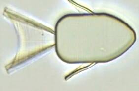 Diseñan microbots capaces de liberar medicamentos al interior del cuerpo humano