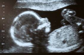 Placenta posee un mecanismo de protección único que evita el ingreso del coronavirus