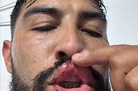 Nicolás Maturana dispara contra el árbitro que lo expulsó ante Deportes Temuco: “Qué asco, una vergüenza”