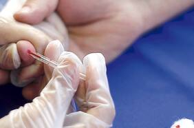 Descubren un marcador en la sangre capaz de predecir la aparición de diabetes hasta 19 años antes del diagnóstico