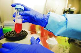 Matar el cáncer de forma natural: científicos desarrollaron un novedoso proceso para producir compuestos con propiedades anticancerígenas