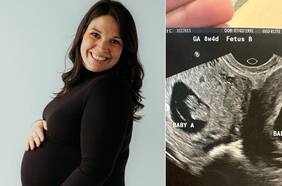 Mujer con dos úteros y doble embarazo sorprende a la comunidad científica