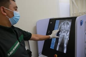 Minsal respaldó eliminación de los escáneres corporales: “Nuestra labor es cuidar a las personas”