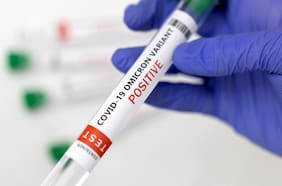 Fact Checking: ¿Variante Ómicron XBB es cinco veces más tóxica que Delta? ¿Primer chileno muerto por viruela del mono padeció el virus casi 50 días?