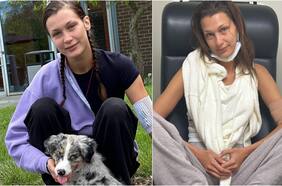 7 síntomas poco conocidos de la enfermedad de Lyme, el diagnóstico que afectó a Bella Hadid