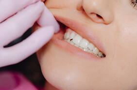 Por impureza detectada: ISP ordena retiro de lotes de medicamento usado para dolores bucales