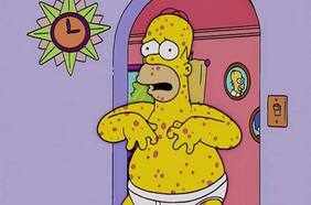 Fact checking: ¿Los Simpsons predijeron la viruela del mono? ¿Rusia expulsa a la OMS de su territorio?