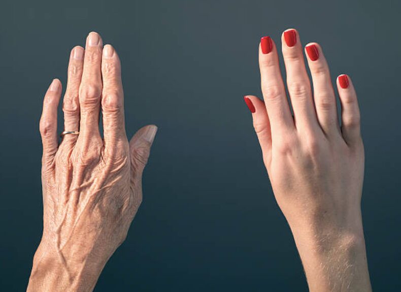 Age
