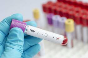 Columna de Opinión de Carolina Rojas y Jorge Gallardo: “Linfoma y VIH en Chile”