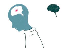Estudio en 84 mil personas: Covid-19 envejece el cerebro en 10 años y disminuye CI en 8,5 puntos
