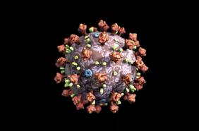 Estudio sugiere la principal causa de muerte por Covid-19