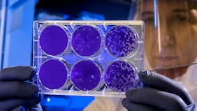 Estas son las células que podrían convertirse en la cura para las enfermedades autoinmunes