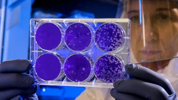 Estas son las células que podrían convertirse en la cura para las enfermedades autoinmunes