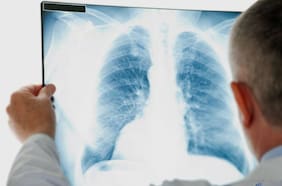 Día Mundial de la Radiología: Más de un 80% de las decisiones médicas la requieren