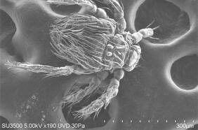 Orientia chiloensis, la bacteria que provoca alza de peligroso tifus que amenaza a quienes hacen trekking