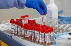 ¿Cómo discernir entre la avalancha de estudios sobre el coronavirus? Chilenos crean sistema de inteligencia artificial para diferenciar información del virus