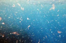 Un problema humano y animal: científicos descubren que patógenos terrestres “viajan” al mar por los microplásticos