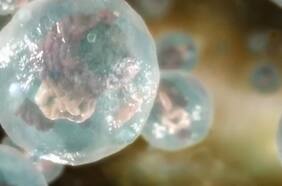 Se registró el primer caso de una mujer en ser posiblemente curada de VIH