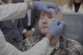 Primicia médica: hombre recibe con éxito el primer trasplante de ojo completo del mundo