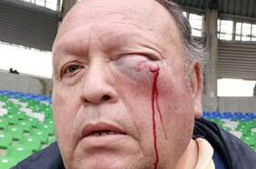 Denuncian que Mauricio Viana agredió gravemente a un hincha tras la caída de Puerto Montt ante Barnechea