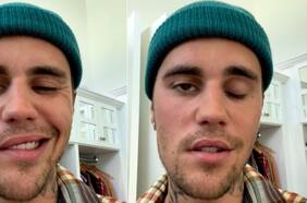 Síndrome de Ramsay Hunt: ¿Qué es el raro trastorno que Justin Bieber dice que le paralizó la cara?