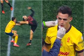 La brutal patada en la cabeza de Nicolás Díaz que le costó la expulsión en México