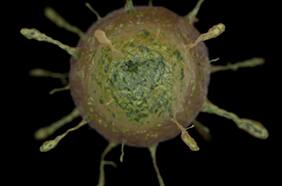 Descubren principal causa de la esclerosis múltiple