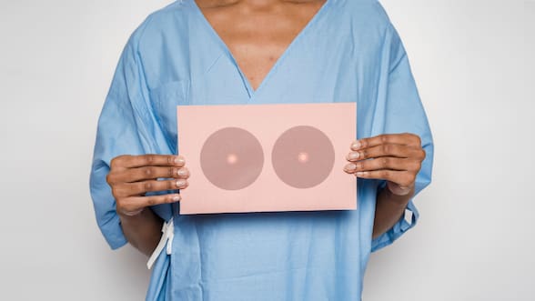 Entre el miedo, el trabajo y los cuidados: las barreras que alejan a las mujeres de la mamografía