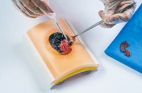Como un pequeño laboratorio digital en Valparaíso de dos diseñadores hoy entrena a médicos creando extremidades en 3D