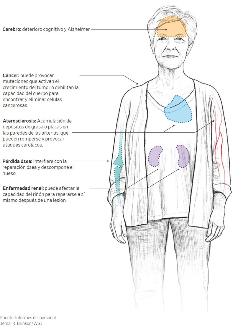 Inflammatory aging is chronic, stealthy and can pose a serious threat to health