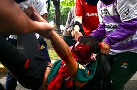 En riesgo vital: registran momento en que periodista argentino es agredido con bomba lacrimógena por la policía