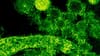 Qué es el virus de los Andes, la cepa del hantavirus que puede transmitirse entre humanos