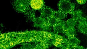 Qué es el virus de los Andes, la cepa del hantavirus que puede transmitirse entre humanos