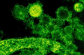 Qué es el virus de los Andes, la cepa del hantavirus que puede transmitirse entre humanos