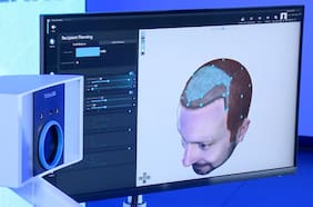 Scanner capilar con inteligencia artificial