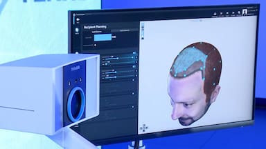 Scanner capilar con inteligencia artificial