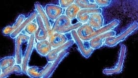 La OMS confirma un brote potencialmente letal del virus de Marburgo en Etiopía