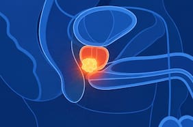 El innovador tratamiento de cáncer de próstata en solo cinco sesiones, liderado por una oncóloga chilena