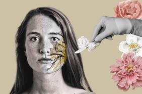 Mi vida antes y después de un espasmo hemifacial